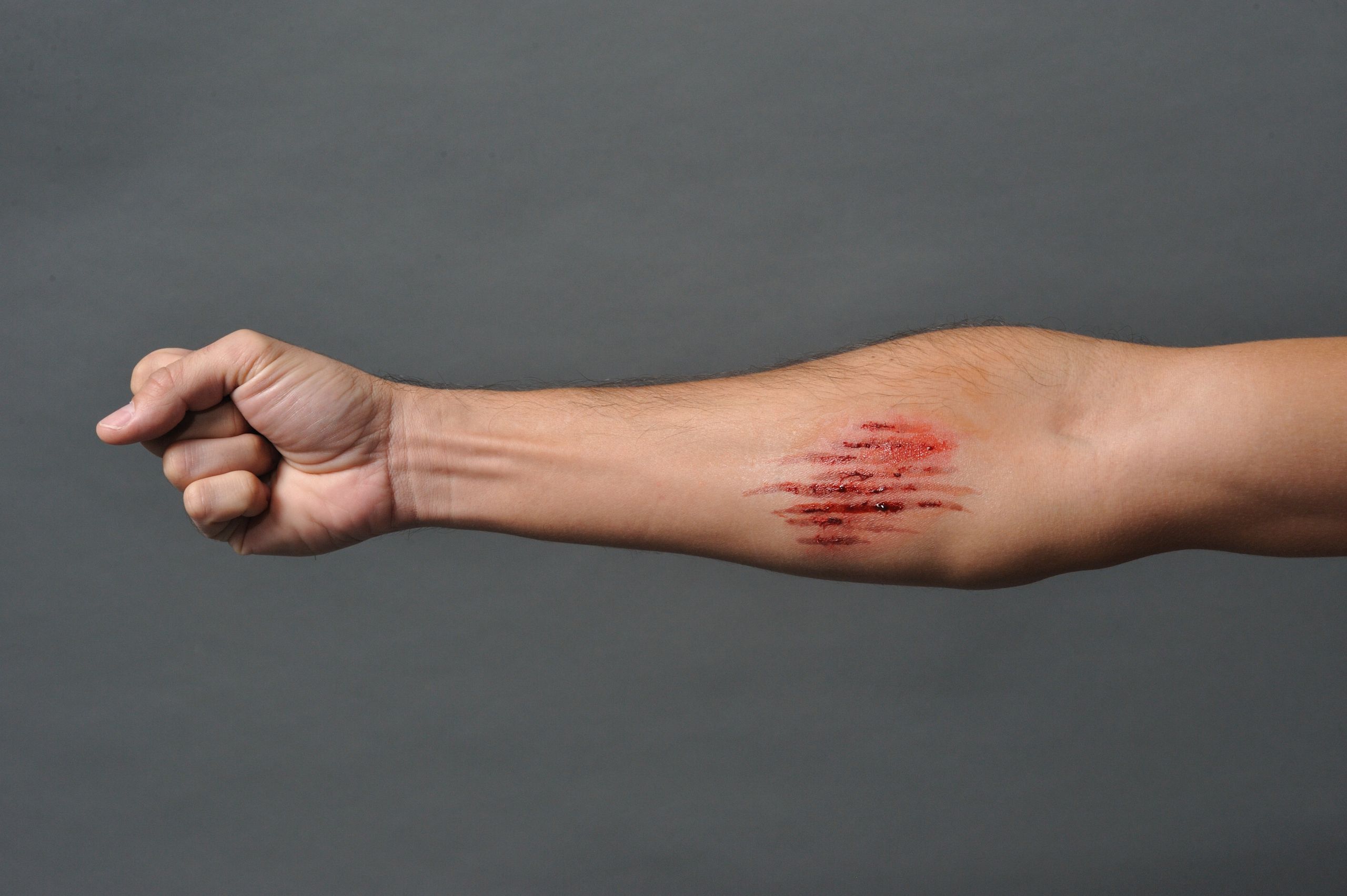 Abrasion - Trauma Tattoo - Image 2