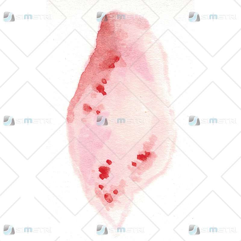 2nd Degree Burn Trauma Tattoo