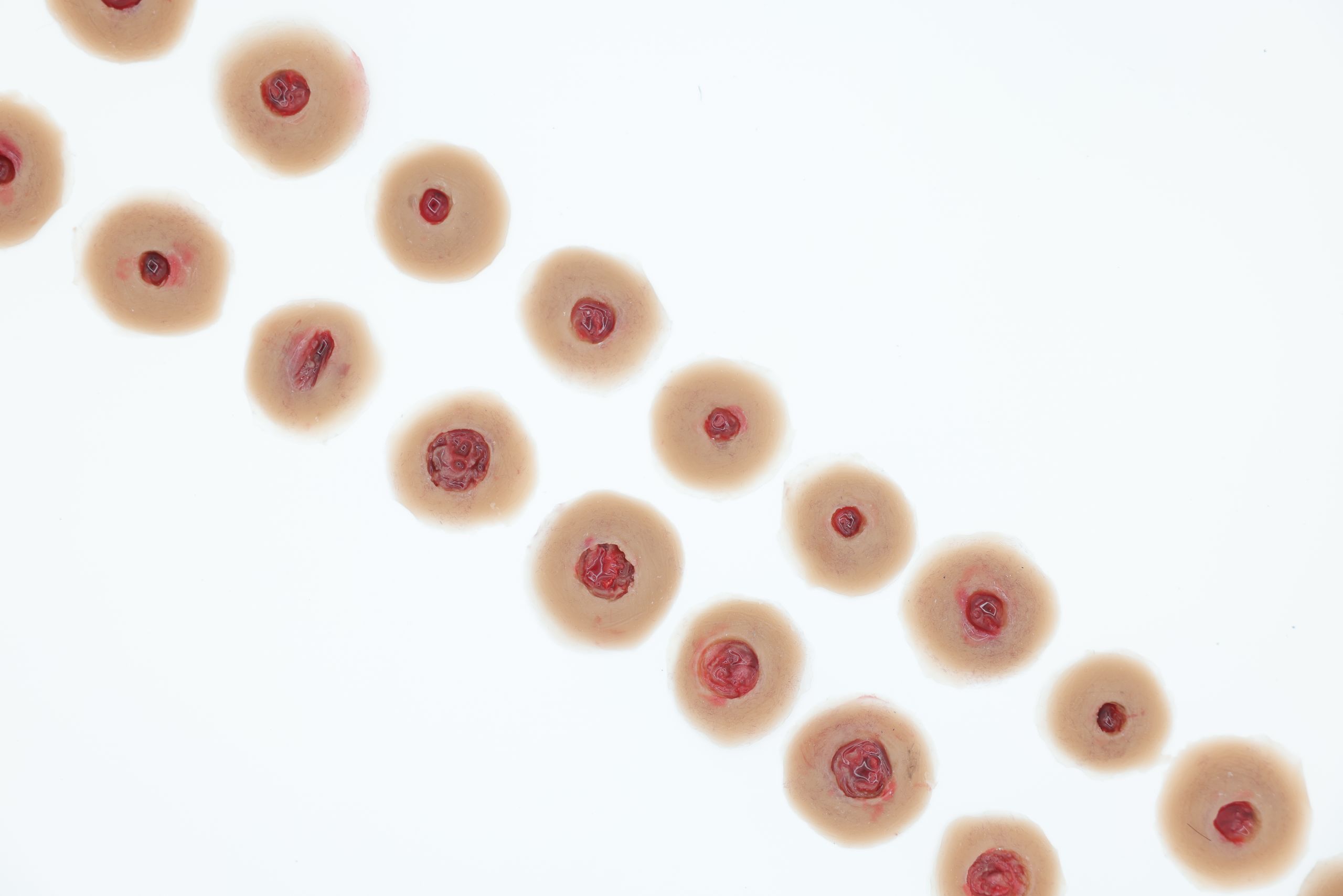 Entrance Wound - Image 5