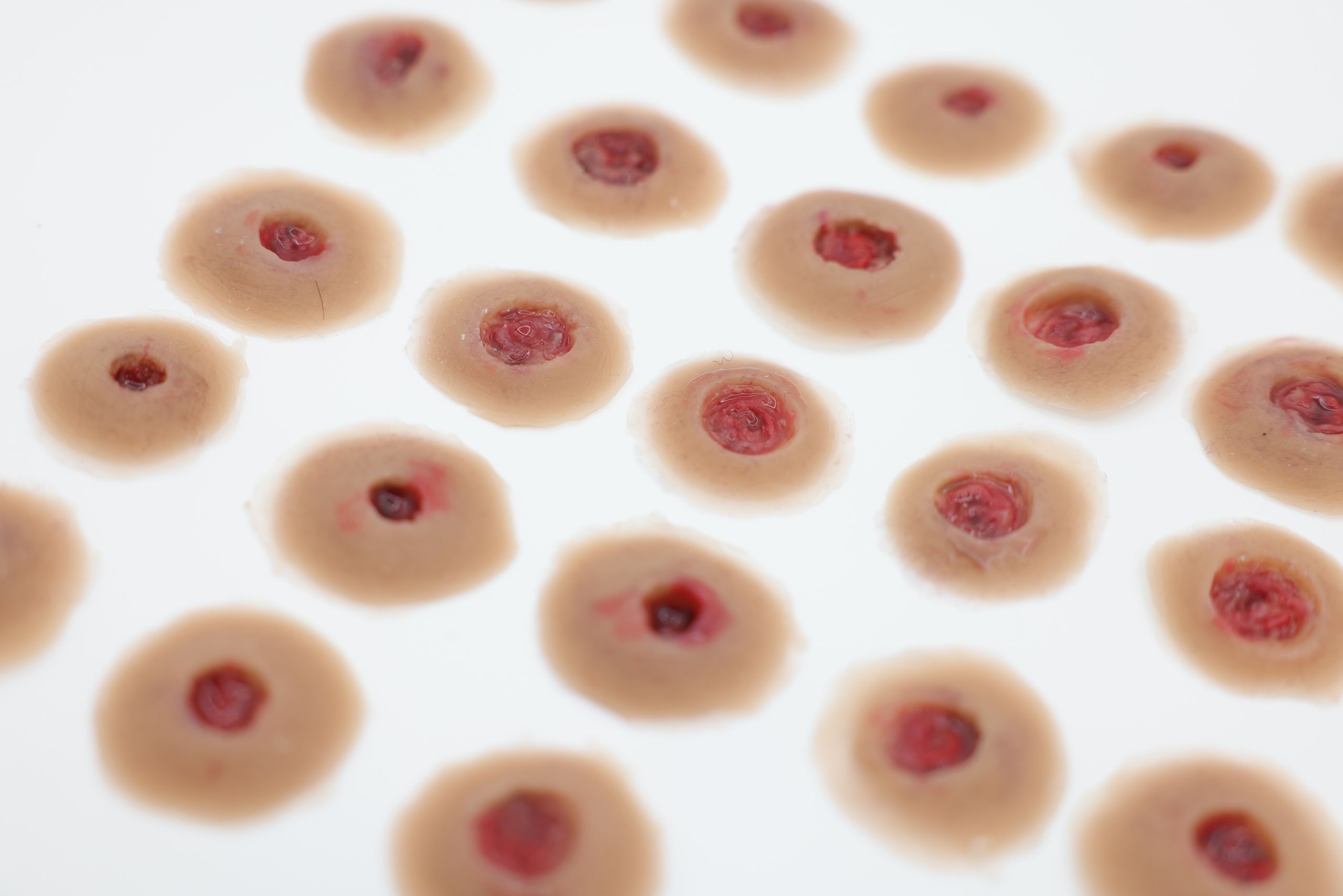 Entrance Wound - Image 6