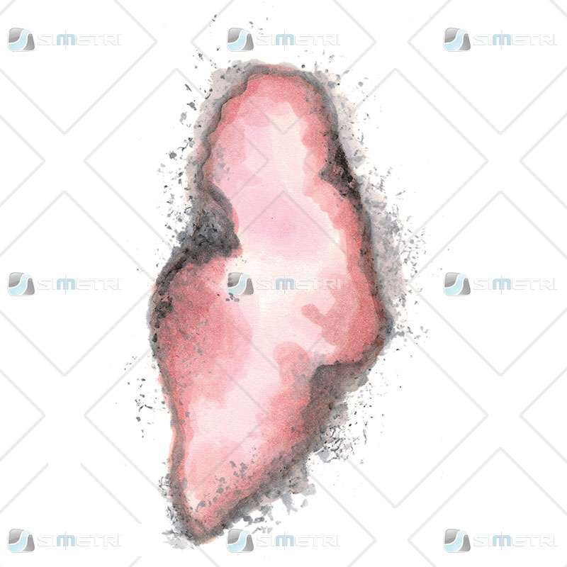 3rd Degree Burn Trauma Tattoo