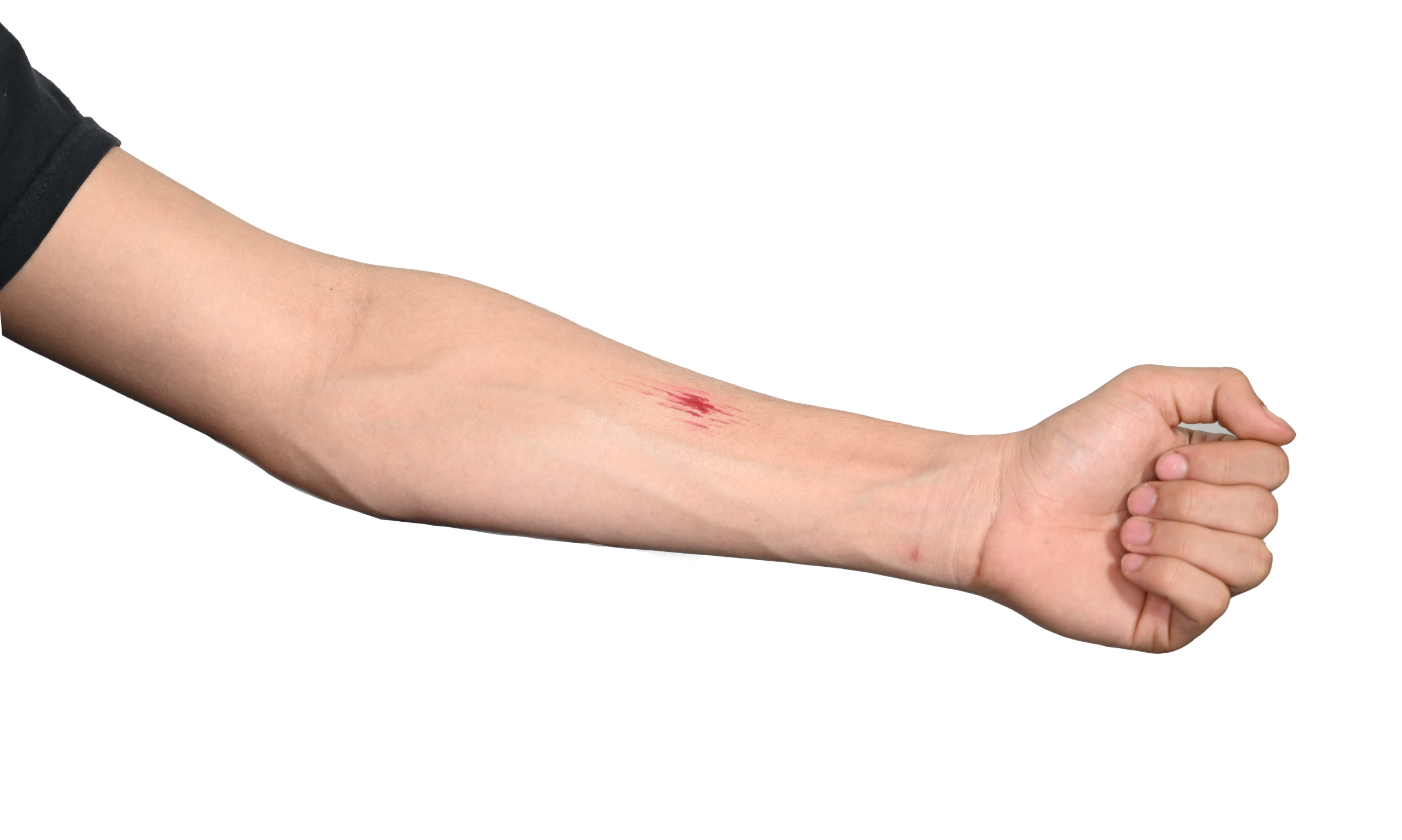 Abrasion - Trauma Tattoo - Image 3