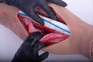 SIMETRI Lower Leg Fasciotomy Part Task Trainer