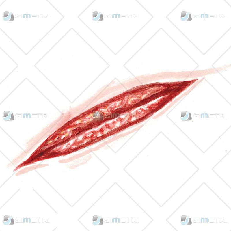 Laceration Trauma Tattoo - Image 2