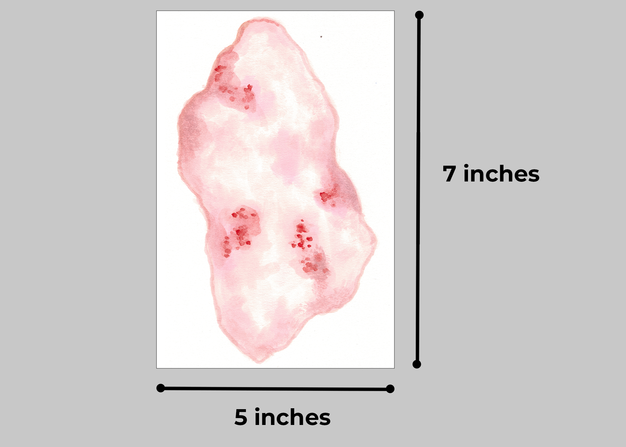 2nd Degree Burn Trauma Tattoo - Image 6