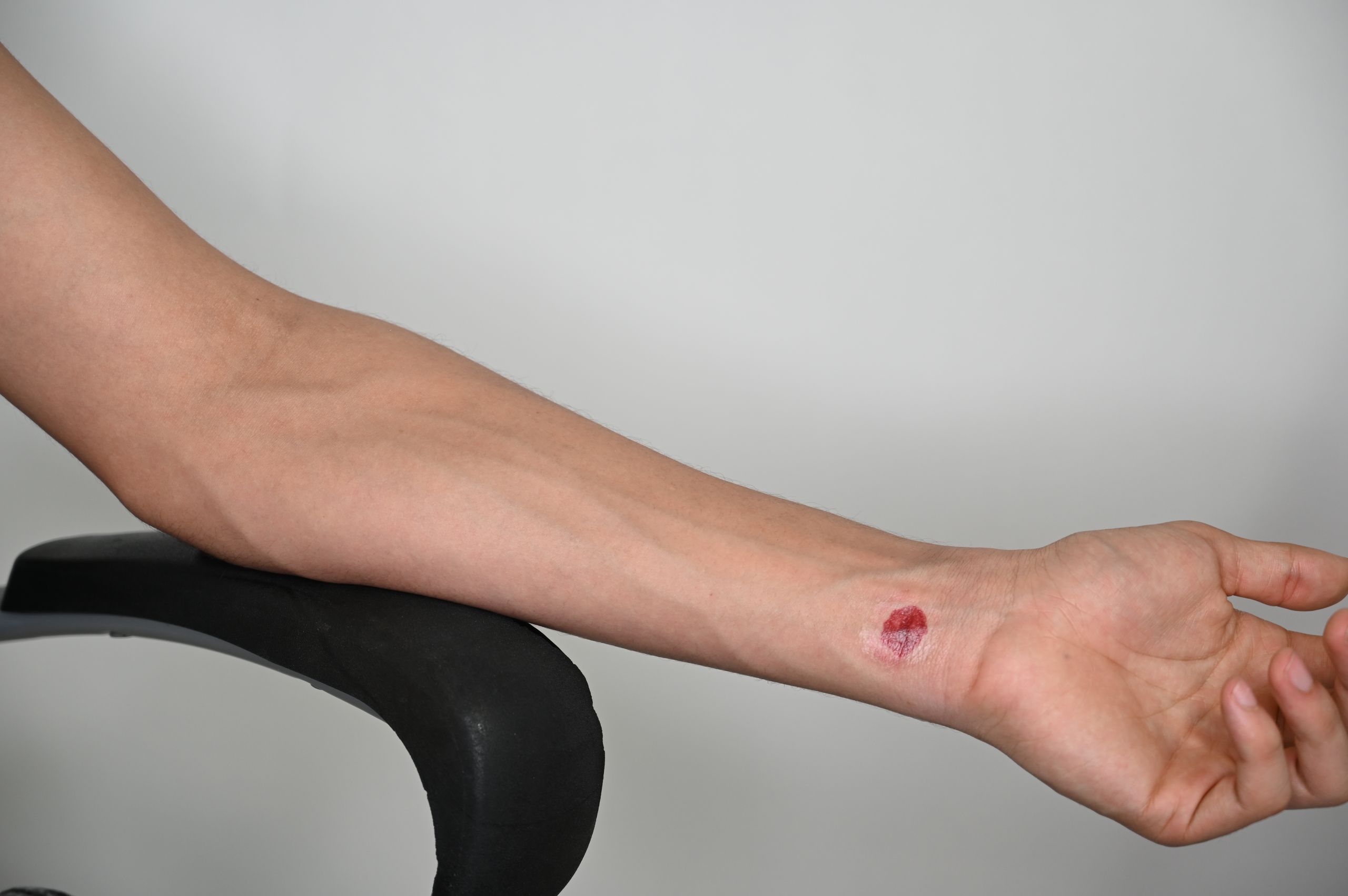 Entrance Wound - Small - Image 4